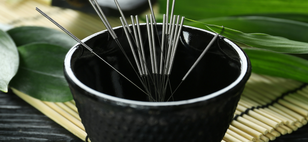 Women's Health Centre - Holistic Health Care - Acupuncture, Needles, Chinese Medicine, Tradition